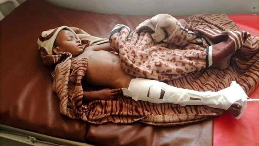 Children injured after a camp for displaced people in Tigray